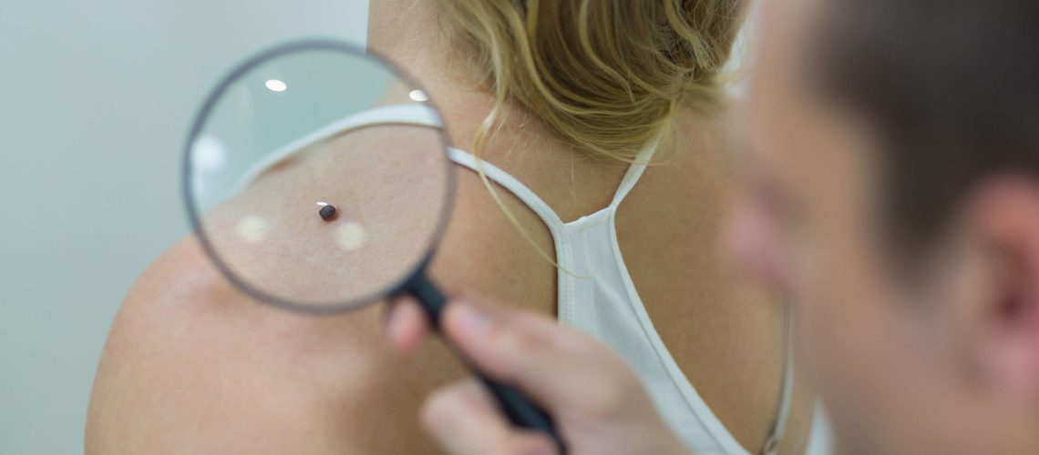 Idaho Resident Skin Examination By Dermatologist