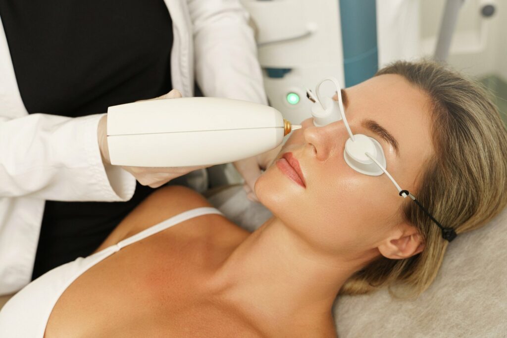 IPL photo rejuvenation treatment